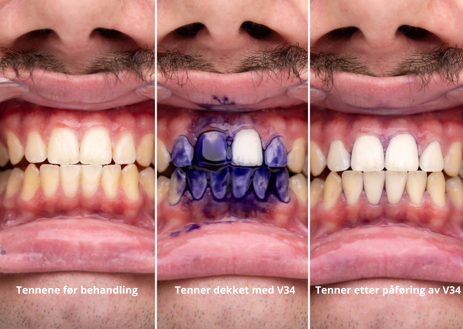 V34 Colour Corrector