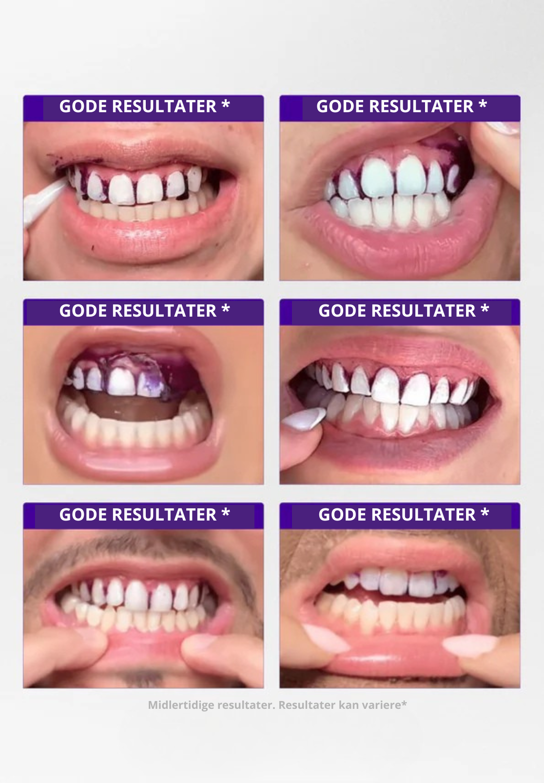 V34 Blekestrips